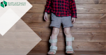 What is Rickets?
