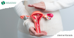 Uterine fibroids