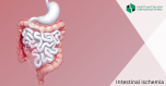 Diagnosis and Treatment of Intestinal Ischemia