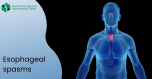 Спазм пищевода – когда следует обратиться к врачу?