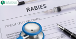 Do not miss the symptoms of rabies - what signs do people and  animals show during the virus?
