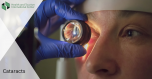 Cataract - methods of prevention