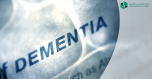 Dementia prevention methods