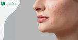A dangerous triangle on the face - it is not allowed to lie on the muzzle