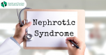 Nephrotic syndrome - a disease due to which a large amount of protein is excreted in the urine