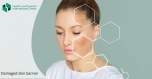 If you are familiar with these symptoms, your skin barrier is damaged