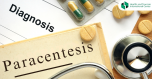 Paracentesis - Draining excess fluid from the abdominal cavity