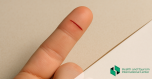 How to treat a paper cut?