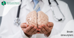 თავის ტვინის ანევრიზმა - დიაგნოსტირებისა და  მკურნალობის მეთოდები