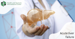 How is acute liver failure treated?
