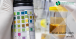 Why is urine dark in color - possible causes