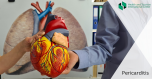 Pericarditis - symptoms and causes
