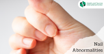 How does the structure of the nail change in the background of a  health problem?