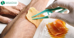 Which diseases occur due to chronic inflammation?