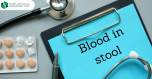 If you notice blood in the stool - the causes