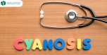 Cyanosis - if the skin, lips or nails have a blue tint