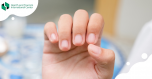 What does the appearance of the nail say about the state of health?