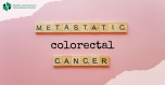 Metastatic colorectal cancer