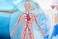 Vascular surgery