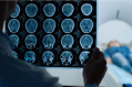 Neurosurgery