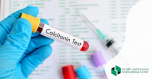 Determination of calcitonin concentration in the blood