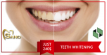 White teeth and dreamy smile for only 240$