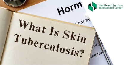 Cutaneous tuberculosis