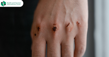 Why doesn't a scab heal?