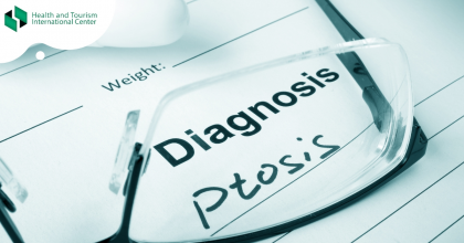 Ptosis - drooping eyelid