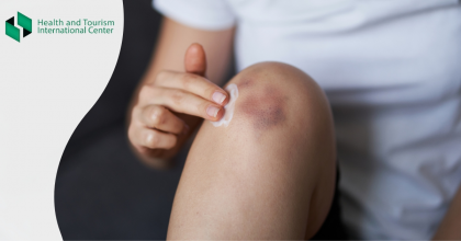 Strange bruises - bruises that you can't explain and you don't know why they happened