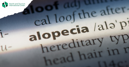 Alopecia areata - an autoimmune disease that causes hair loss