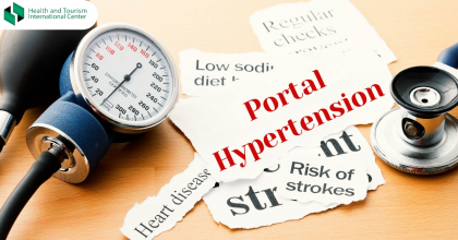 პორტული ჰიპერტენზია