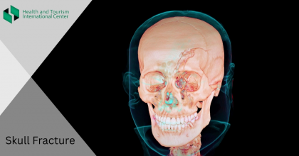 Skull Fracture