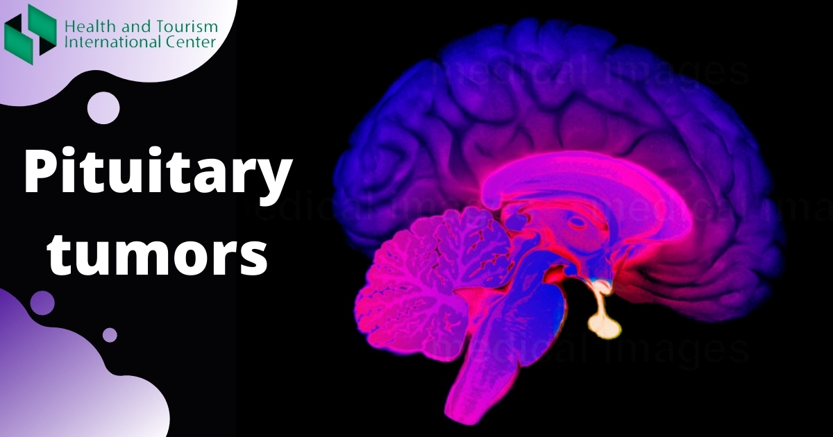 Pituitary tumor