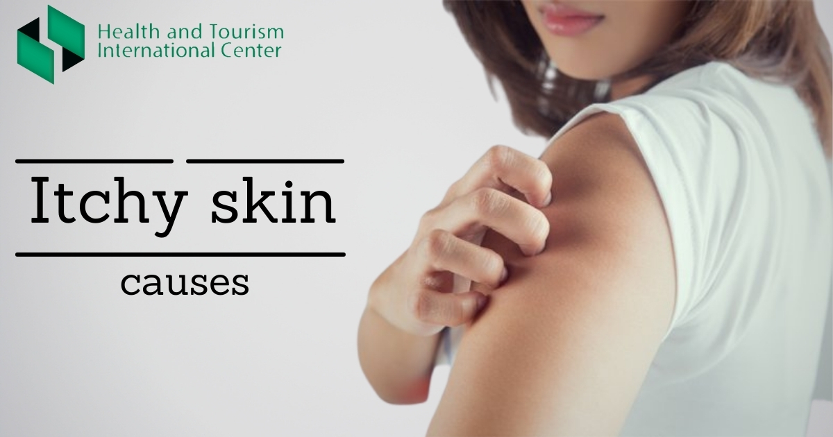 Causes of itchy skin