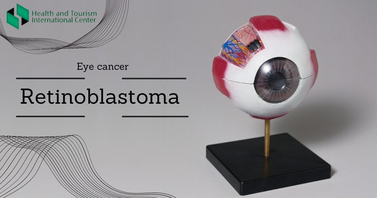 Retinoblastoma is an eye cancer that begins in the retina. - HTI ...