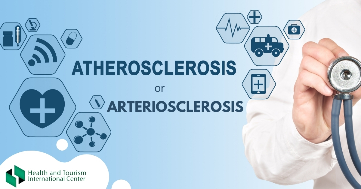 Arteriosclerosis and atherosclerosis