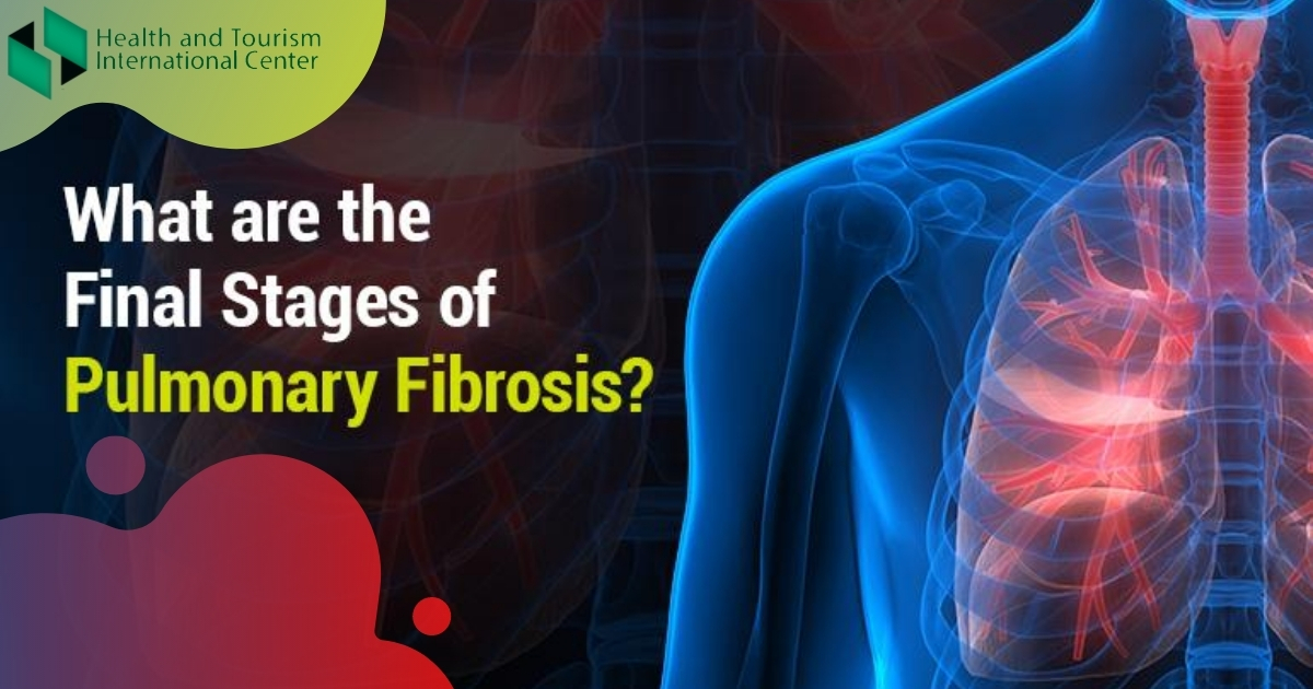 Pulmonary fibrosis- What causes lung tissue damage? - HTI CENTERS ...