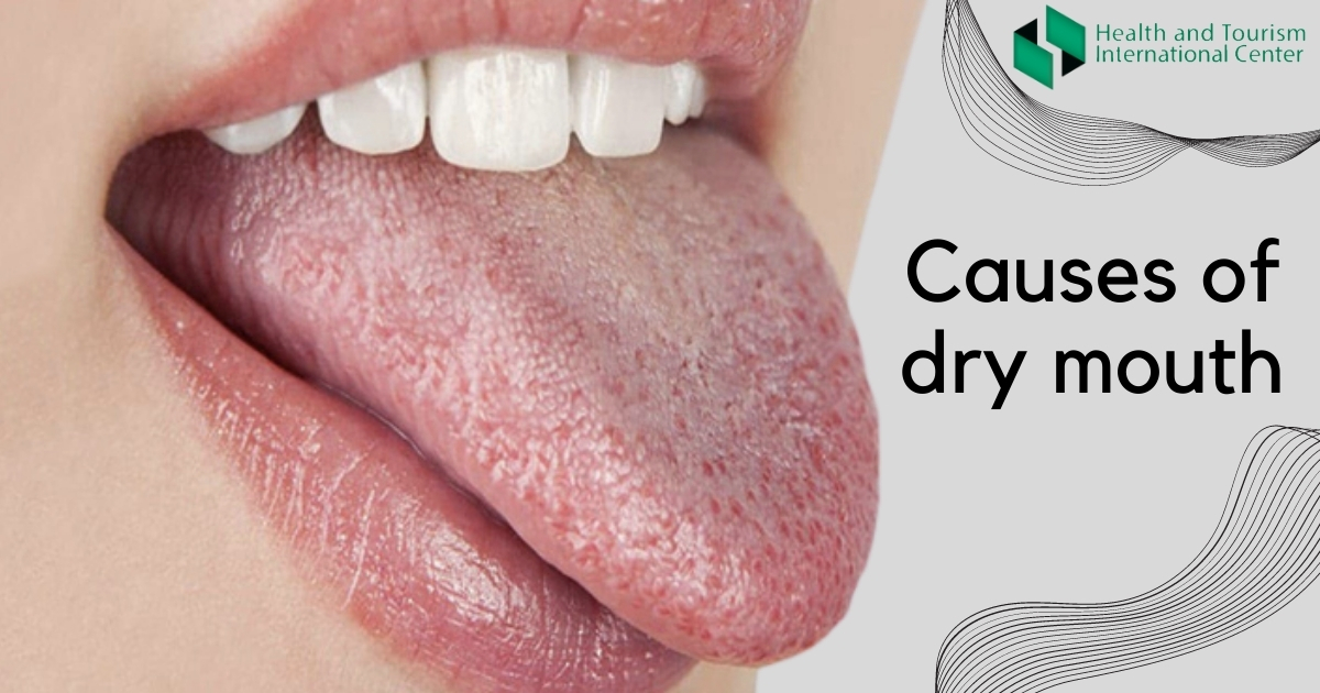 What is dry mouth?