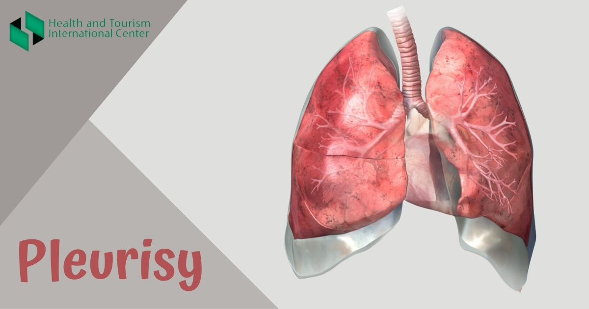 Pleurisy - Symptoms and causes of the inflammation of pleura