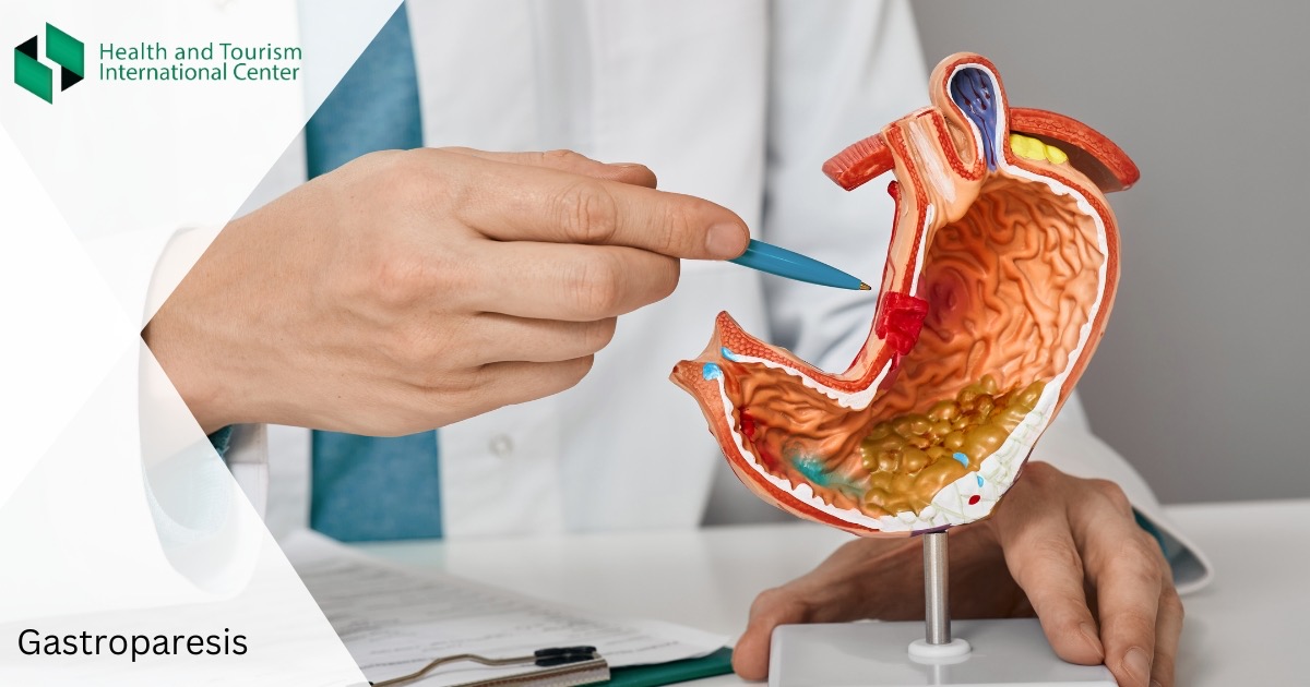 გასტროპარეზი - დარღვევა, რომლის გამოც საკვები კუჭში რეკომენდებულზე დიდხანს რჩება