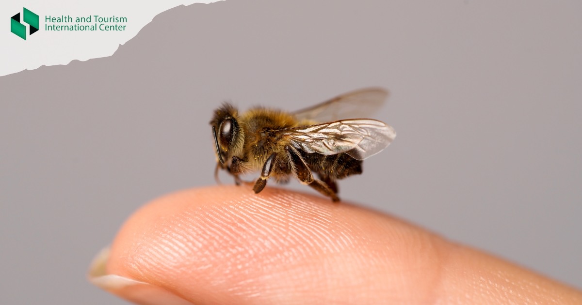 When is a bee sting dangerous and when should you see a doctor?