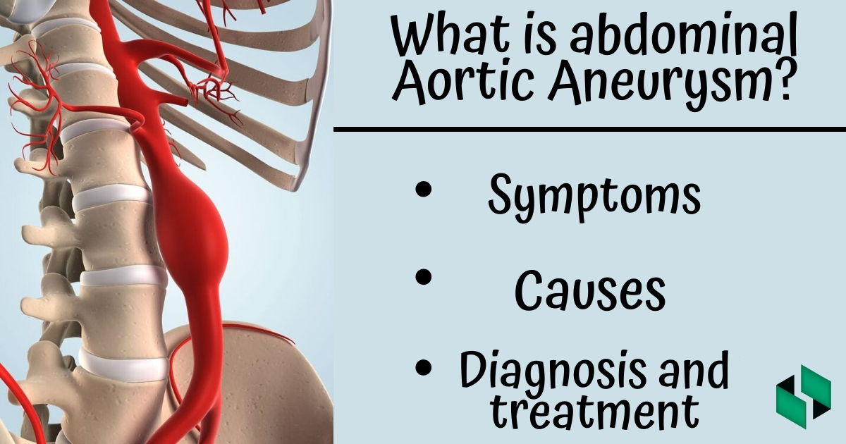 What is Abdominal Aortic Aneurysm?