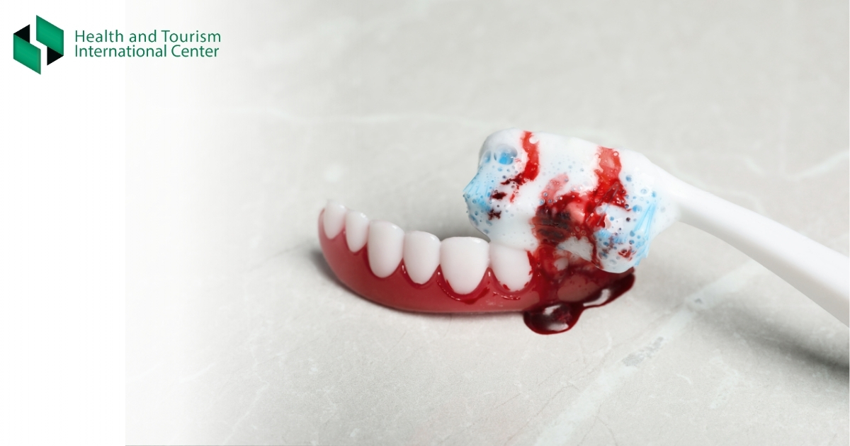 Pericoronitis - Inflammation of the Gum Tissue