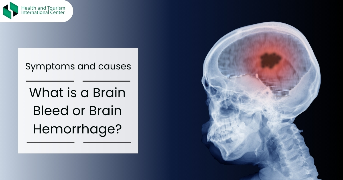Brain hemorrhage - What are the symptoms of a brain hemorrhage?