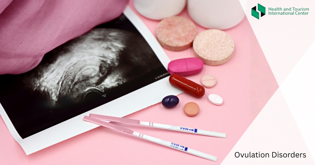 ოვულაციის დარღვევა