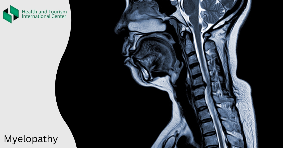 მიელოპათია - როგორ მკურნალობენ ზურგის ტვინის კომპრესიას?