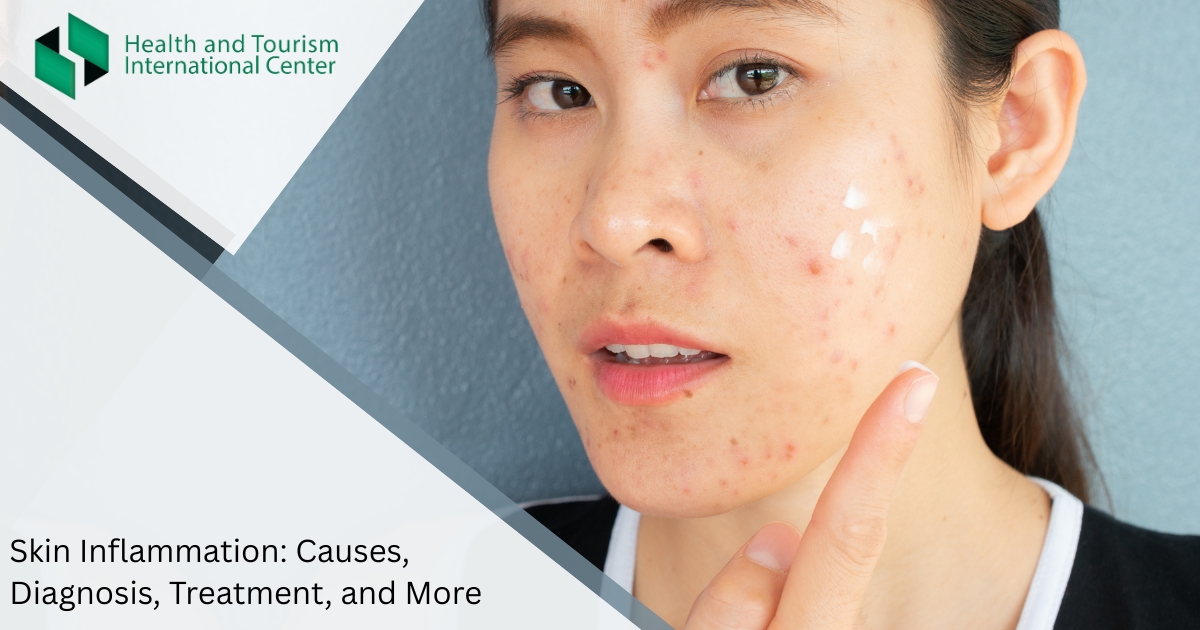 Воспалительный процесс на коже