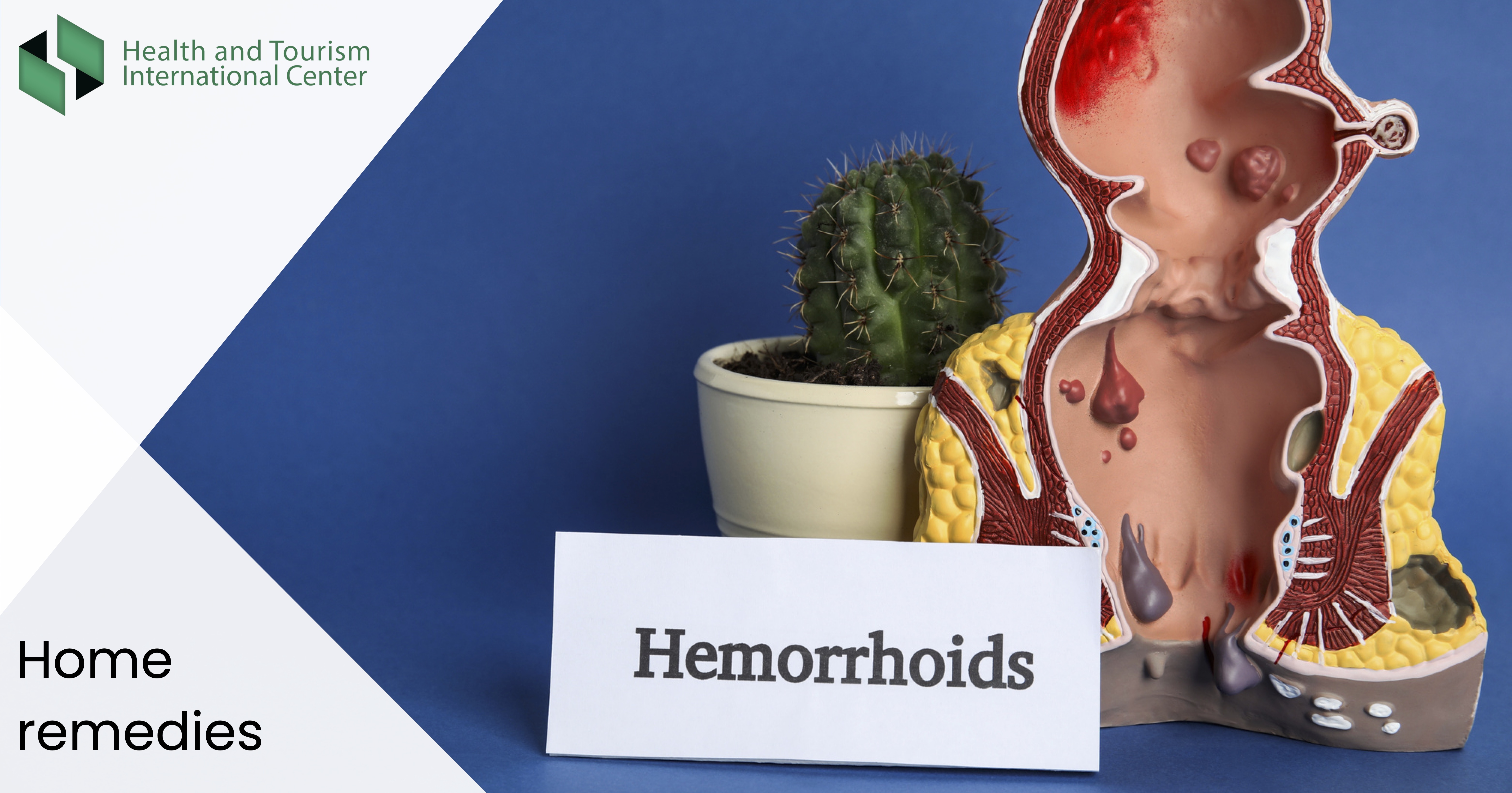 If you have hemorrhoids - methods to relieve discomfort (treatment at home)