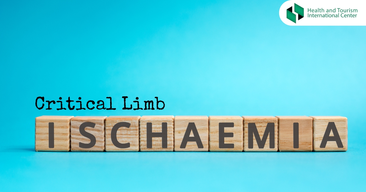 Critical limb ischemia - a life-threatening condition that leads to amputation in some patients